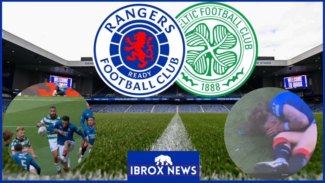 Rangers badge, Celtic badge